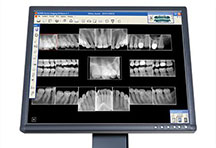 Dental Xrays Fairway KS